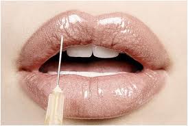 lip injectables